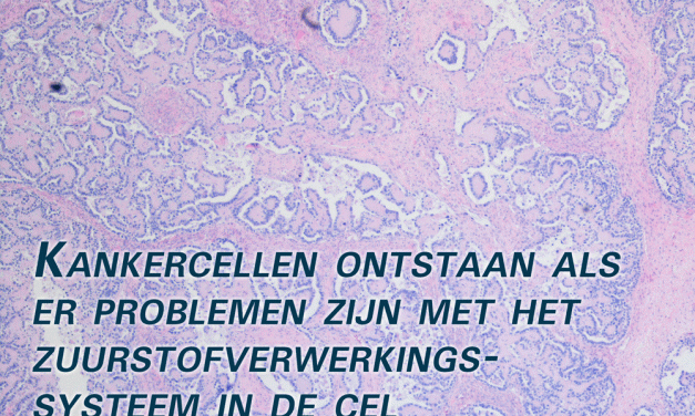 Een andere visie op kanker
