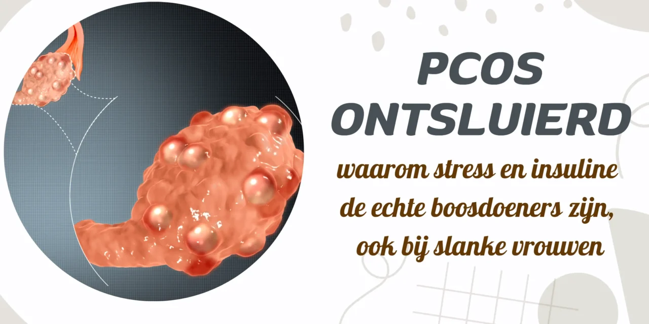 PCOS: een mogelijk signaal van insulineresistentie en stress